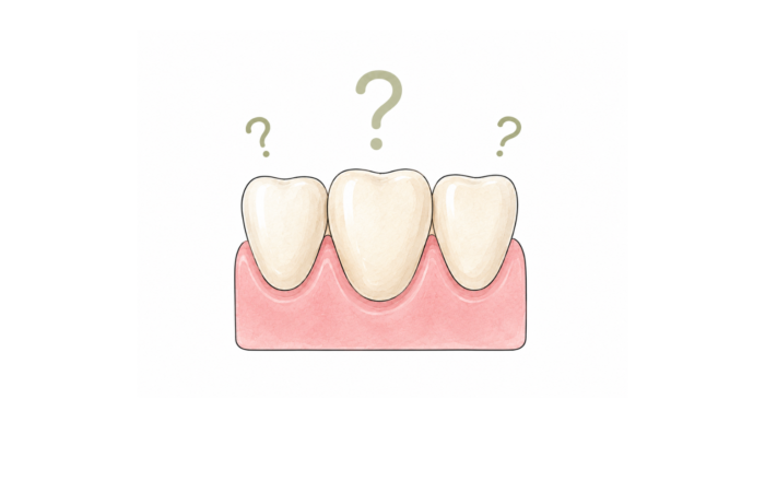 Pourquoi mes dents sont-elles jaunes ?