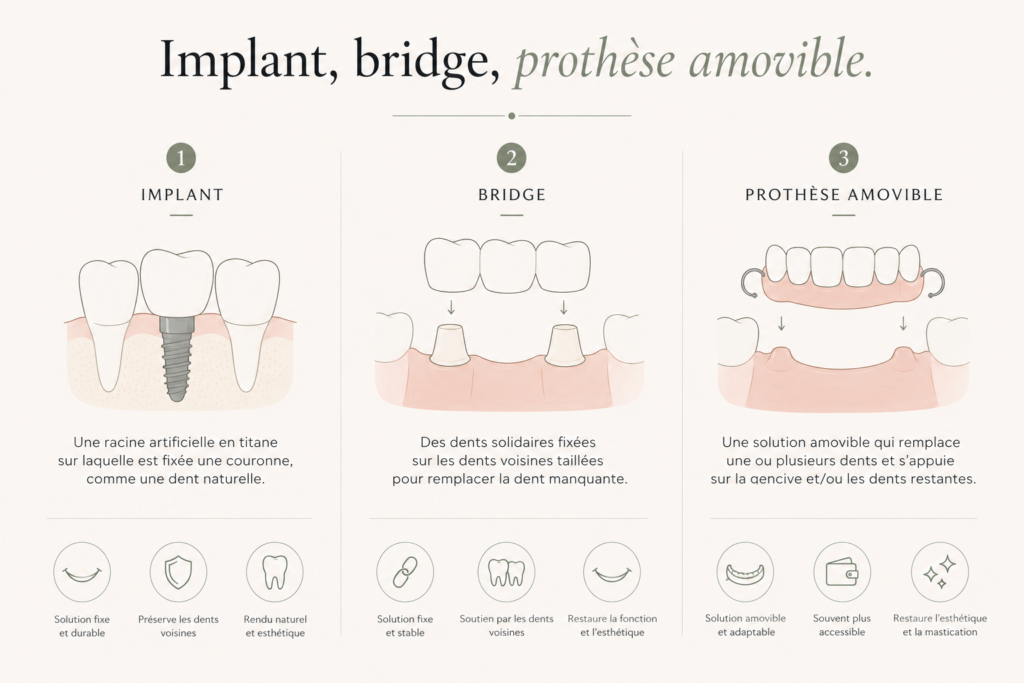  Comparatif illustré des trois solutions.